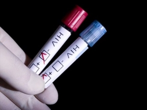 ΚΕΕΛΠΝΟ: Μειώση των νέων περιστατικών HIV λοίμωξης