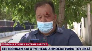 Γαρουφαλιάς για επίθεση Ρομά: «Με χτύπησαν την ώρα του ρεπορτάζ»