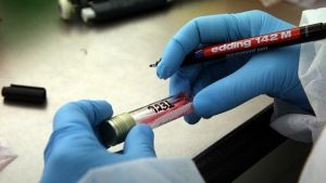 Θετικός στην Covid-19 o αντιδήμαρχος Κιλκίς Γιώργος Μπαλάσκας