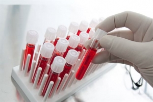 Δωρεάν εξετάσεις για AIDS και ηπατίτιδα στις 18-25 Νοεμβρίου