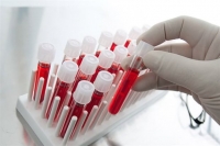 Δωρεάν εξετάσεις για AIDS και ηπατίτιδα στις 18-25 Νοεμβρίου