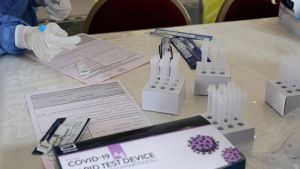 Κύπρος: Καταργήθηκαν τα δωρεάν rapid test για τον γενικό πληθυσμό