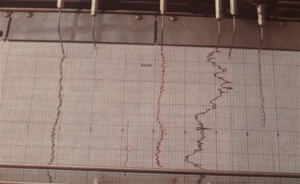 Σεισμική δόνηση 4,1 βαθμών Ρίχτερ στην Κεφαλονιά