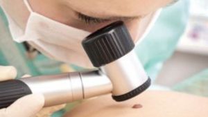 Έρευνα: Ποιοι κινδυνεύουν περισσότερο από μελάνωμα και καρκίνο του προστάτη