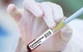 Κίνα: Χορηγεί πειραματικά εμβόλια σε άτομα υψηλού κινδύνου