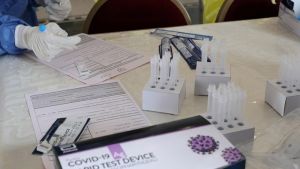 Κύπρος: Ξεκινάει η νέα φάση της στρατηγικής σταδιακής άρσης των περιορισμών