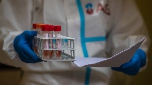 1.269 νέα κρούσματα Covid-19– 136 στη Θεσσαλονίκη