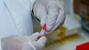 Κύπρος: 2 θάνατοι και 1.925 νέα κρούσματα