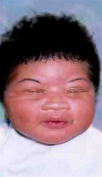 Κορίτσι που απήχθη λίγο μετά τη γέννησή του βρέθηκε 18 χρόνια μετά