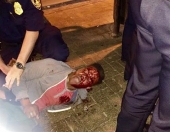 ΗΠΑ: Νέο περιστατικό βίας από αστυνομικούς κατά Αφροαμερικανού