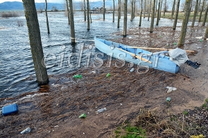 Η Δοϊράνη της… πλαστικούρας!